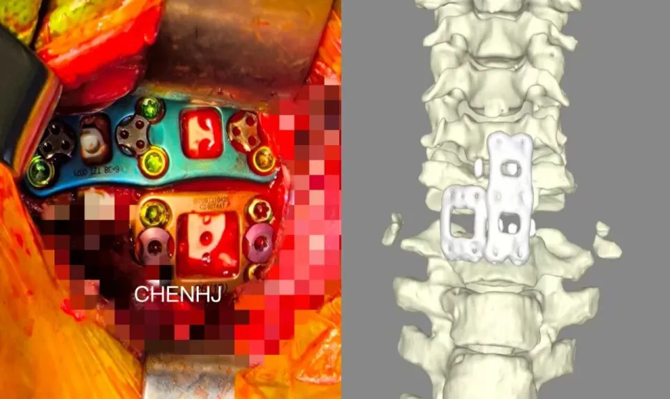 641 (1).webp (1).png